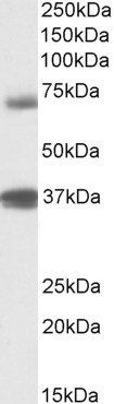 TRIM29/ATDC Antibody