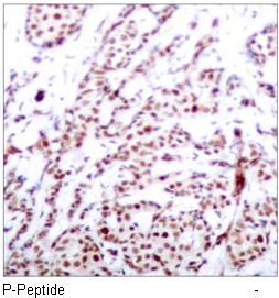 ATF2 (Phospho-Thr73 or 55) Antibody