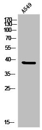 ATF4 Antibody