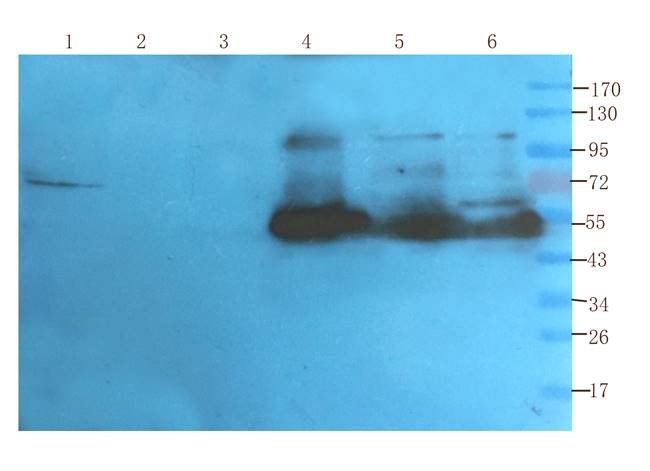 ATF6 antibody