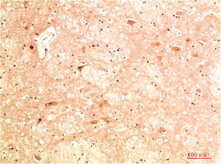 ATG13 Antibody