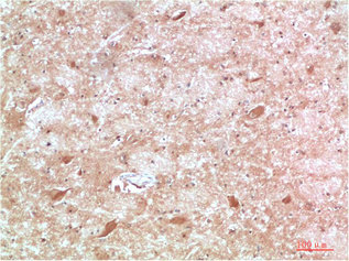 ATG13 Antibody