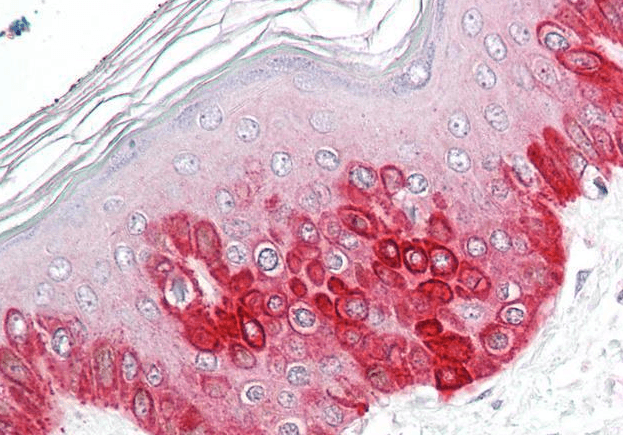 ATG16L1 Antibody