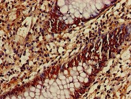 ATG4B Antibody
