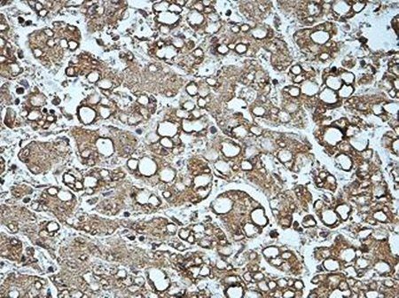 ATHL1 Rabbit Polyclonal Antibody