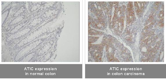 Mouse Human ATIC Antibody