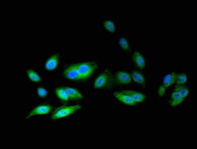 ATIC Antibody