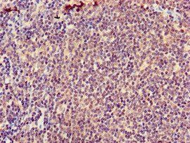 ATIC Antibody