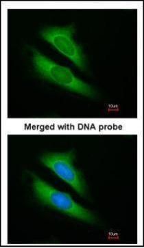 ATIC antibody