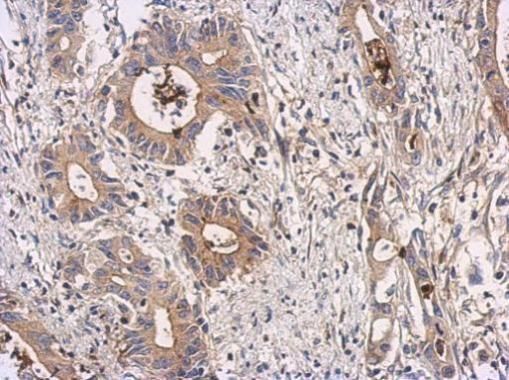 ATIC antibody