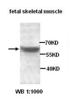 ADAMTSL1 Rabbit Polyclonal Antibody