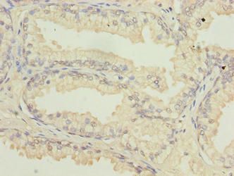 ATL2 Antibody