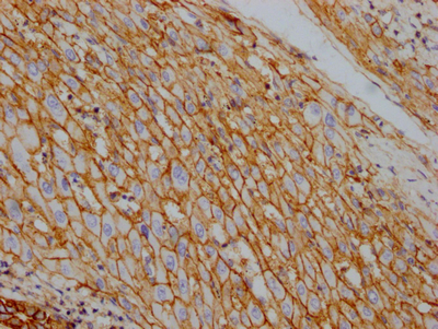ATP1A1 Antibody