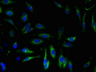 ATP2A2 Antibody