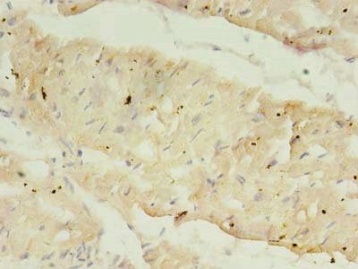 ATP2A2 Antibody