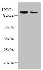 ATP2A2 Antibody
