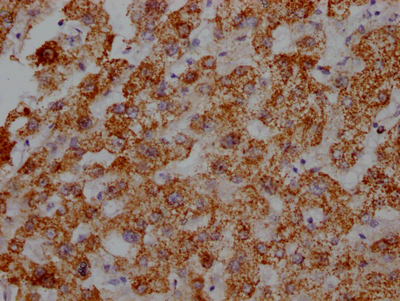 ATP5B Antibody