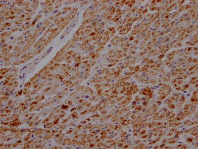 ATP5B Antibody