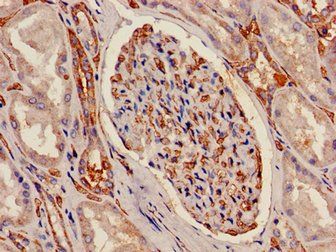 ATP5C1 Antibody