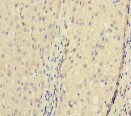ATP5F1D Antibody