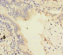 ATP5F1D Antibody