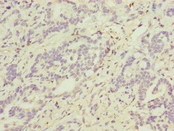 ATP5D Antibody