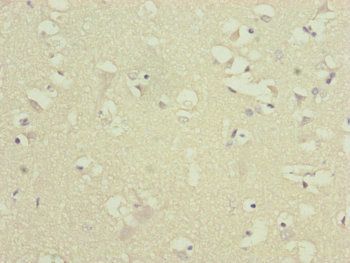 ATP5D Antibody