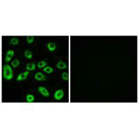 ATP5D Antibody