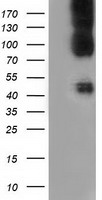 ATP5F1B Antibody