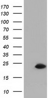 ATP5F1B Antibody
