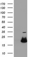 ATP5F1B Antibody