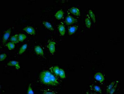 ATP6V0A1 Antibody