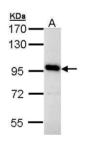 GCM2 Rabbit Polyclonal Antibody