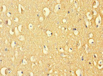 ATP6V1G2 Antibody