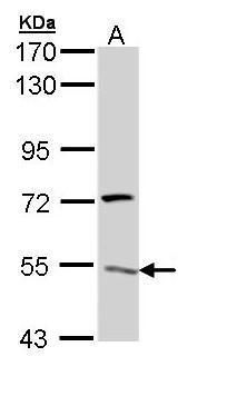 ATP6V1H Rabbit Polyclonal Antibody