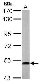 ATP6V1H Rabbit Polyclonal Antibody