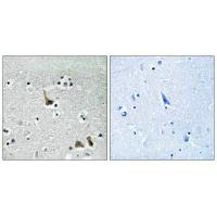 ATP6V1H Antibody