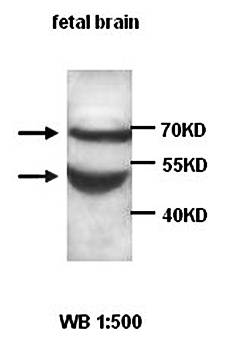 ADAMTS5 Rabbit Polyclonal Antibody