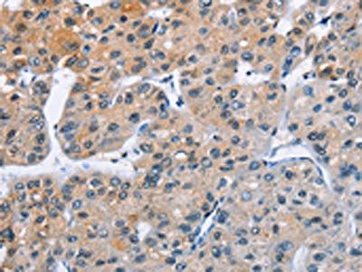 ATXN1 Antibody
