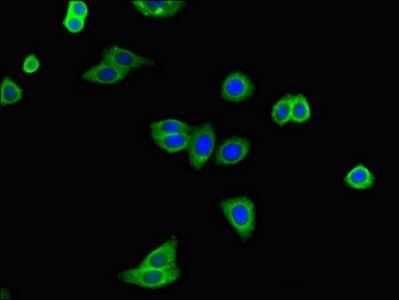 ATXN2 Antibody