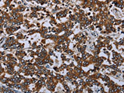 AVEN Antibody