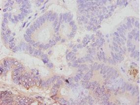 Avpr1a Antibody