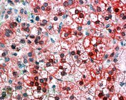 AXIN1 Antibody