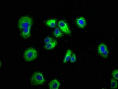 AXIN2 Antibody