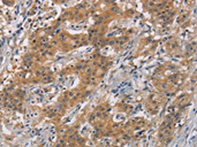 AXIN2 Antibody