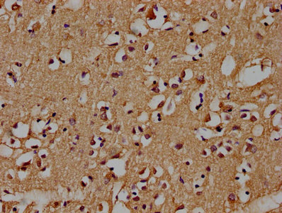AXIN2 Antibody