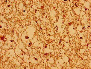 AXIN2 Antibody