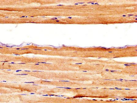 AXL Antibody