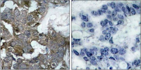 IκB-α (Ab-32/36) Antibody