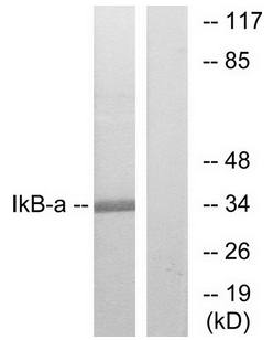 IκB-α (Ab-32/36) Antibody